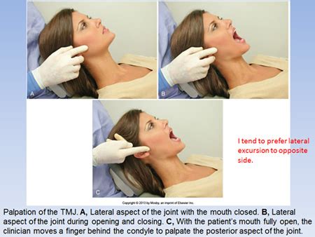 what is a tmj screening